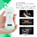 画像2: 超音波診断装置ポケット エコープロ  F2『コンベックス /リニア/フェーズドアレイ 』手軽に持ち運べる軽量 簡単な操作性 訪問診療 人工透析 産婦人科 救急 (2)