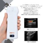 画像2: 超音波診断装置ポケット エコープロ  F6『リニア 』手軽に持ち運べる軽量 簡単な操作性 訪問診療 人工透析 産婦人科 救急 (2)